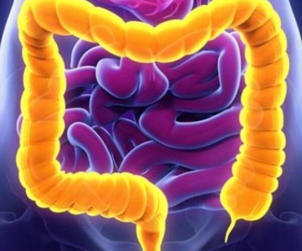 Colitis