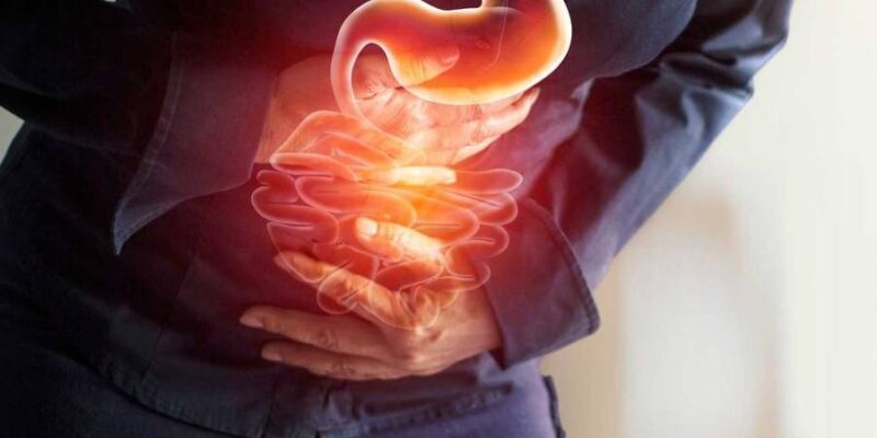 Dyspepsia Dyspepsia