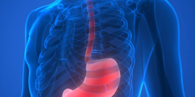 Esophageal Disease Esophageal Disease