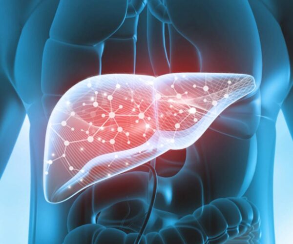 Fatty Liver