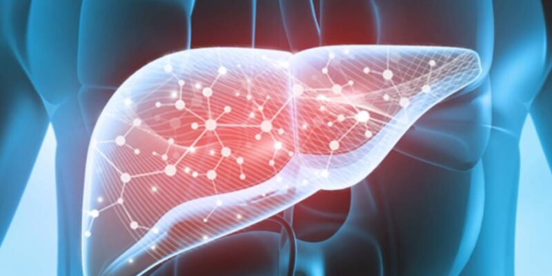 Fatty Liver Fatty Liver