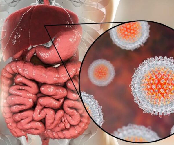 Hepatitis