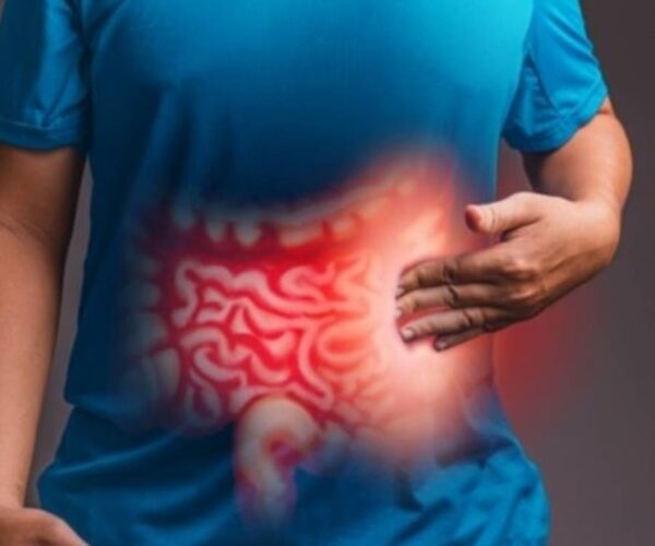 IBS