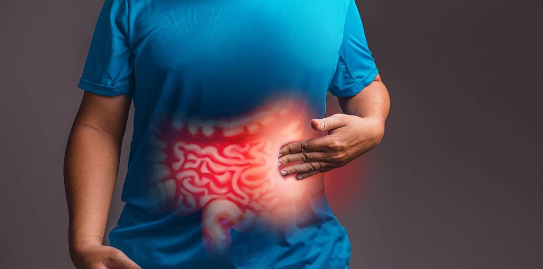 Irritable Bowel Syndrome