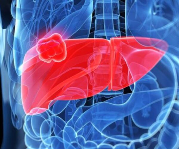 livercancer